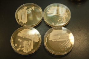 Petri dish of yeast
